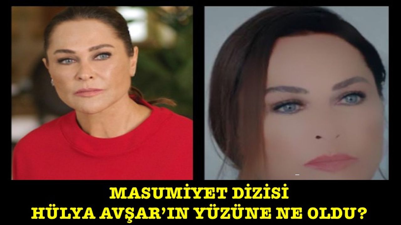 Masumiyet dizisine Hülya Avşar damga vurdu! Yüzüne ne oldu?