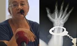 Doktorlar Mücella Yapıcı'dan Kelepçeli Sağlık Muayenesi İçin Özür Diledi! Türk Dişhekimleri Birliği Açıklama Yaptı!