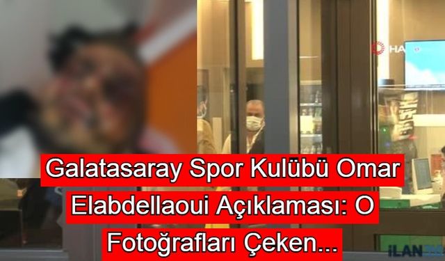 Galatasaray Spor Kulübü'nden Çok Sert Omar Elabdellaoui Açıklaması: O Fotoğrafları Çeken...