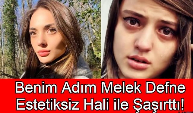 Benim Adım Melek Defne Rabia Soytürk Estetiksiz Hali Şok Etti! Meğer Arabeskçiymiş!