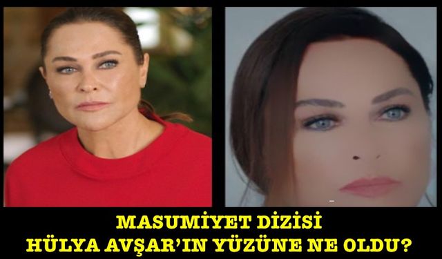 Masumiyet dizisine Hülya Avşar damga vurdu! Yüzüne ne oldu?